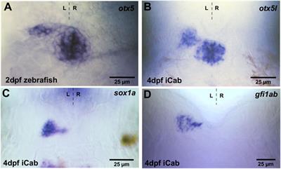 Conserved and diverged asymmetric gene expression in the brain of teleosts